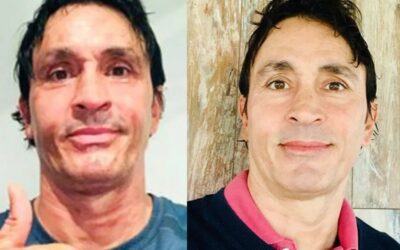 Sebastián Estevanez mostró cómo se recuperó de las quemaduras en la cara